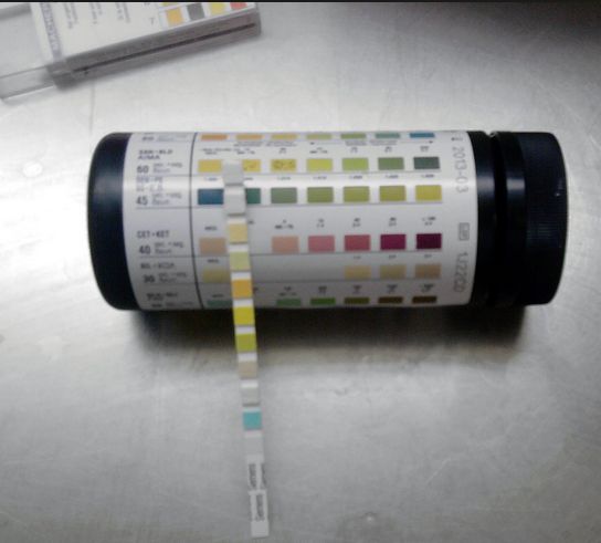 LABORATORIO (2): ANALISIS DE ORINA EN NIÑOS.