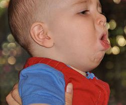 VACUNA  GRIPE  H1N1    Y   NARCOLEPSIA