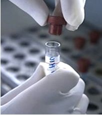 LABORATORIO (1): INTERPRETACIÓN DE LAS PRUEBAS DE LABORATORIO MAS USADAS.