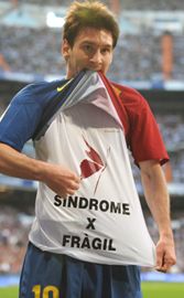 SINDROME DEL CROMOSOMA X FRAGIL