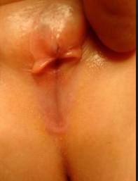 GENITALES FEMENINOS: FUSIÓN DE LABIOS  MENORES: 