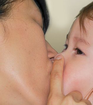 CUERPOS EXTRAÑOS NASALES EN NIÑOS